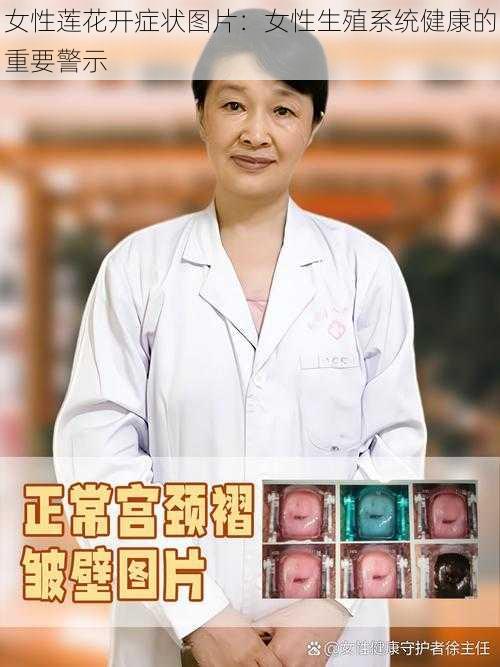 女性莲花开症状图片：女性生殖系统健康的重要警示