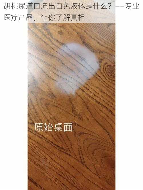 胡桃尿道口流出白色液体是什么？——专业医疗产品，让你了解真相