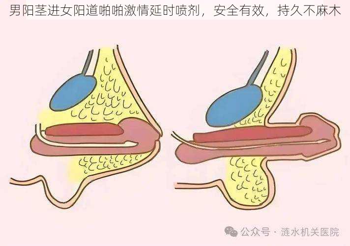 男阳茎进女阳道啪啪激情延时喷剂，安全有效，持久不麻木