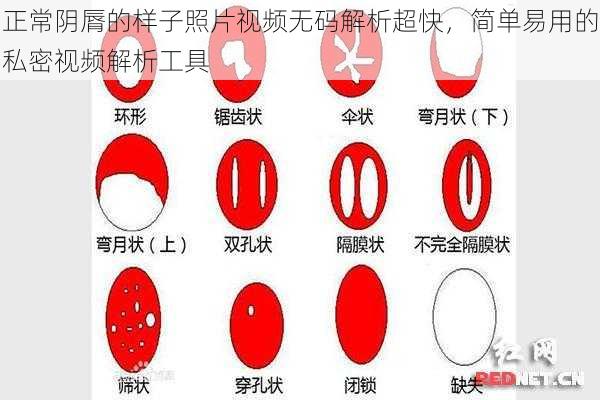 正常阴脣的样子照片视频无码解析超快，简单易用的私密视频解析工具